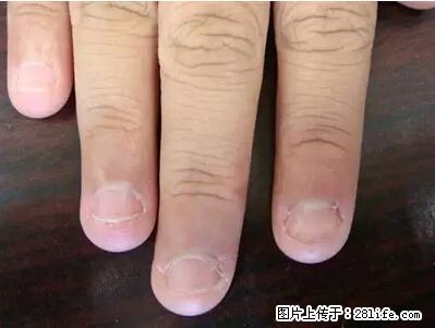 剪指甲、挖耳屎,这些日常小动作竟隐藏大危害! - 商丘生活资讯 - 商丘28生活网 sq.28life.com